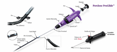 Sistema Proglide 8 Fr Abbott Sistema Proglide 8 Fr Abbott - Angioplastia Periférica