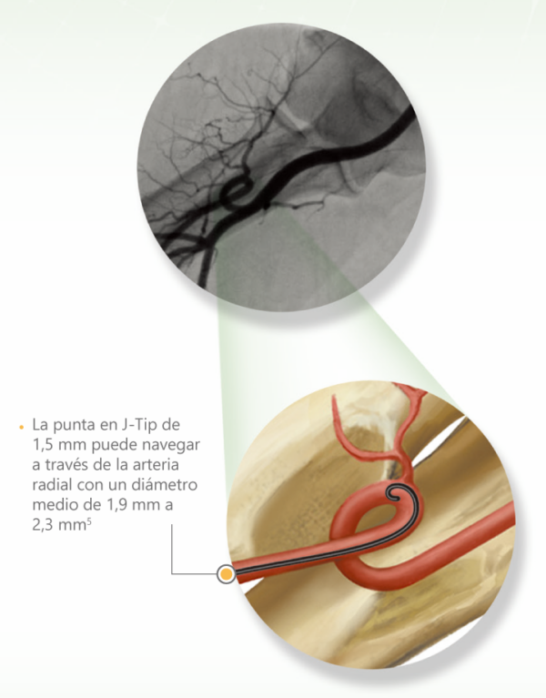 Cuerda Hidrofilica Terumo